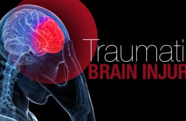 Traumatic Brain Injury Attorneys