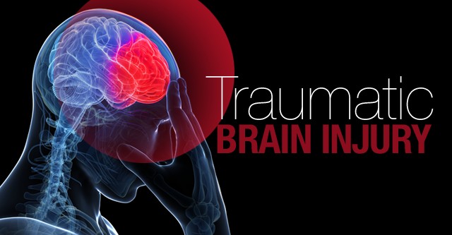 Football and Traumatic Brain Injuries | Traumatic Brain Injury Lawyers  Houston