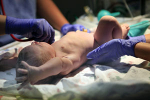 Birth-Injury-Lawyer-Houston-TX-newborn-baby-being-examined